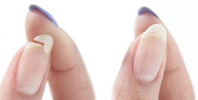 how to fix a vertical split nail Archives - Welcome To Ind Lives News,  Latest News Hindi, Breaking News in Hindi, Live Hindi News Headlines, Top  News India, Current Hindi News World,